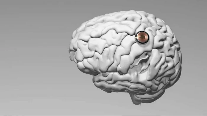 Neuralink Илона Маска ищет претендентов для вживления нейрочипа в мозг