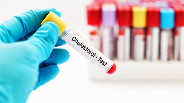 Анализ крови на холестерин: назначение и рекомендации